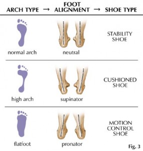 foot-arch-type-photo