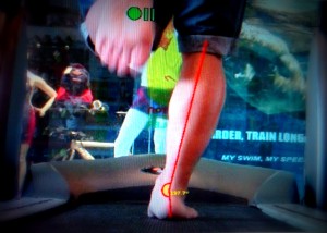 photo-pronation
