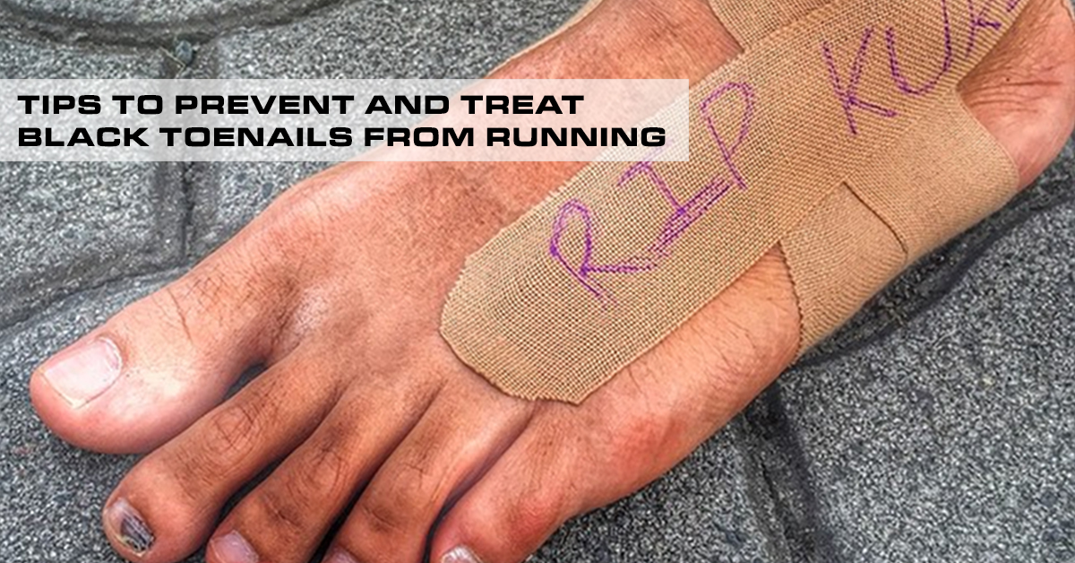 Tips to Prevent and Treat Black Toenails from Running Pinoy Fitness