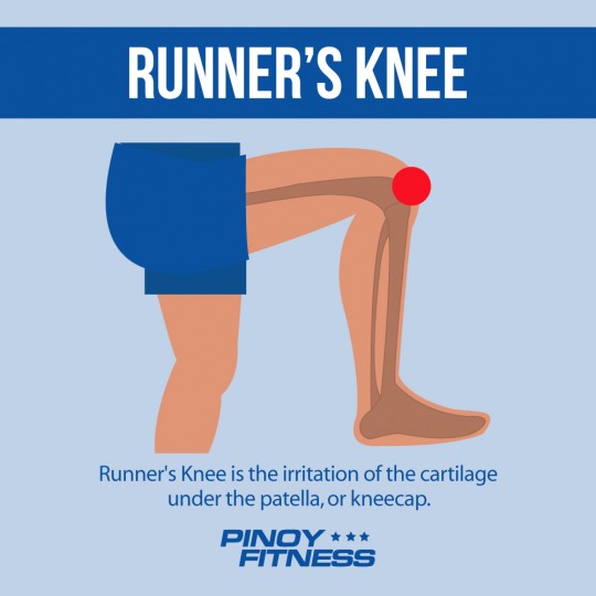 Runners Knee