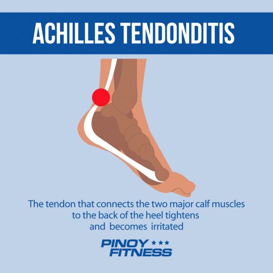 achilles tendonditis 2